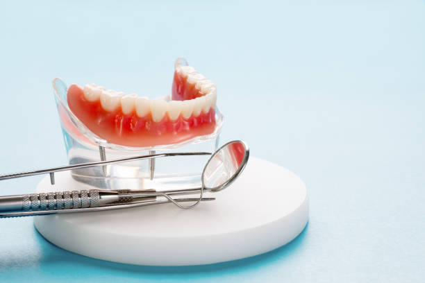 Dental Inlays and Onlays in Robbinsdale, MN